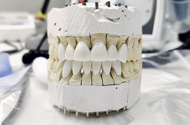 Протезирование зубов