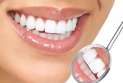 Реставрация зубов