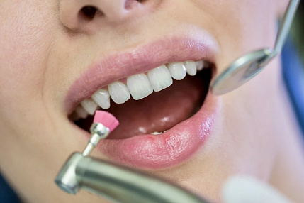 Профессиональная гигиена полости рта